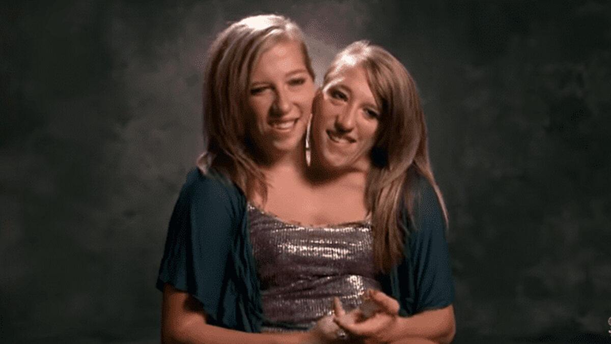 Una din gemenele siameze Abby și Brittany s-a căsătorit. A ascuns asta până acum