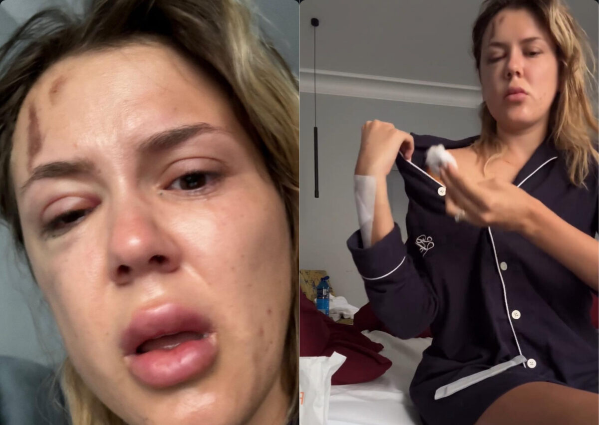 Emily Burghelea, declarații terifiante după accident. Moartea ne-a făcut cu mâna