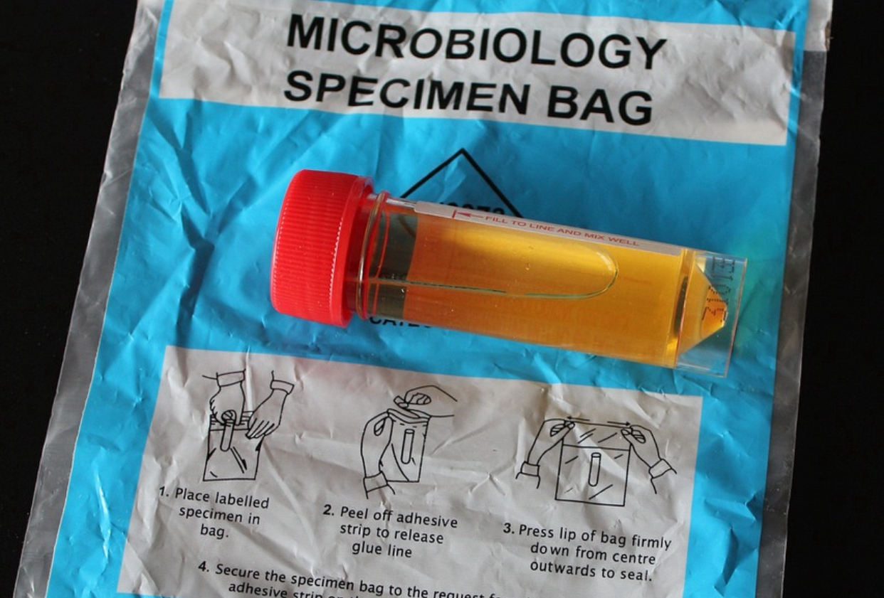 Probe biologice, șoferi