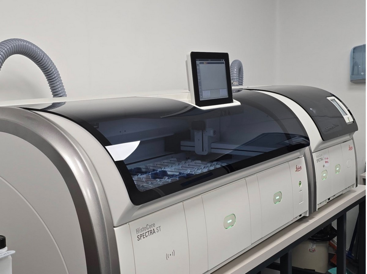 Spitalul din Vestul țării în care se fac analize ce cresc șansele de supraviețuire ale bolnavilor de cancer