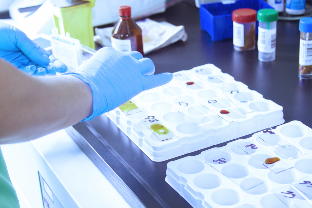 Analize medicale esențiale pentru prevenție și diagnostic rapid