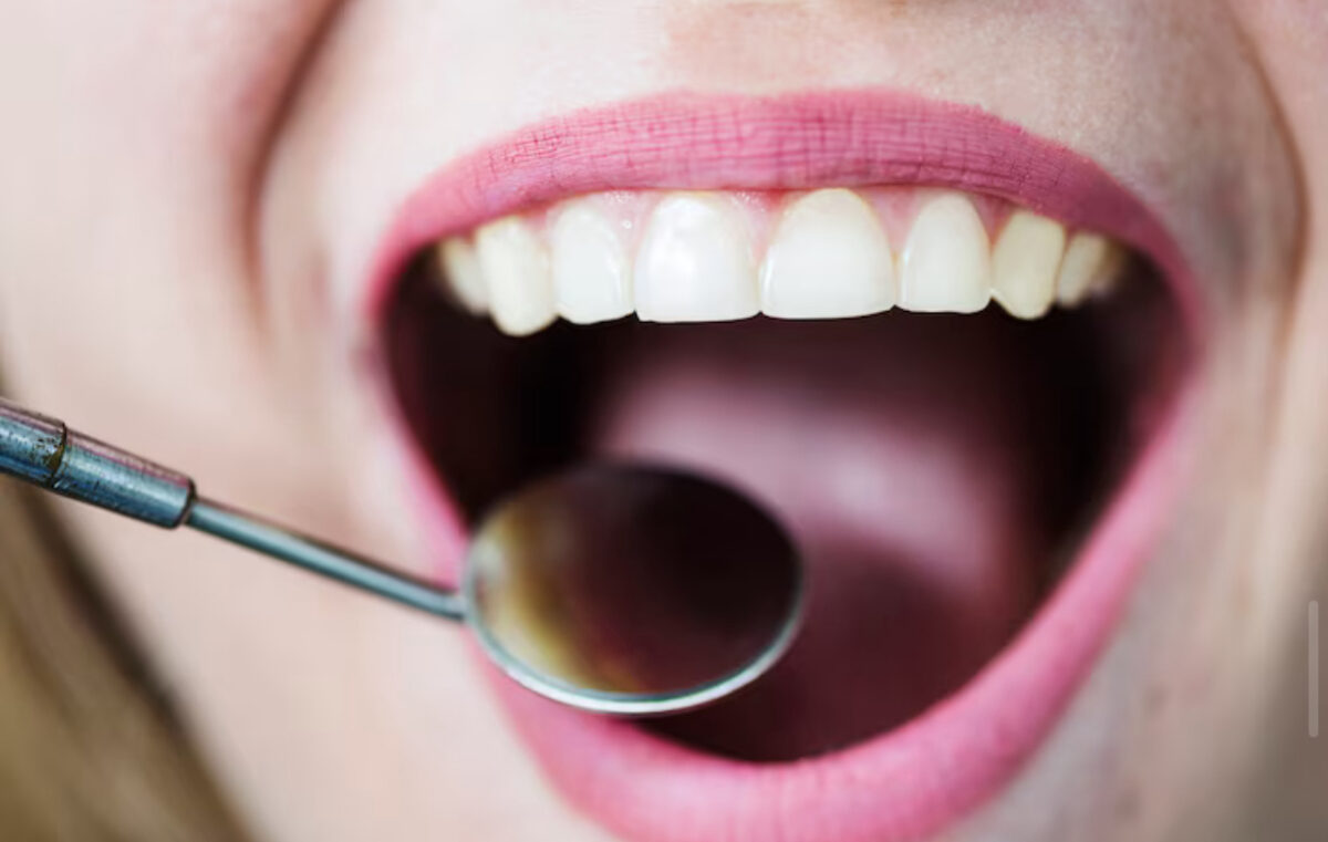 Vizita la stomatolog, un lux pentru mulți români. Cât costă un detartraj în 2025