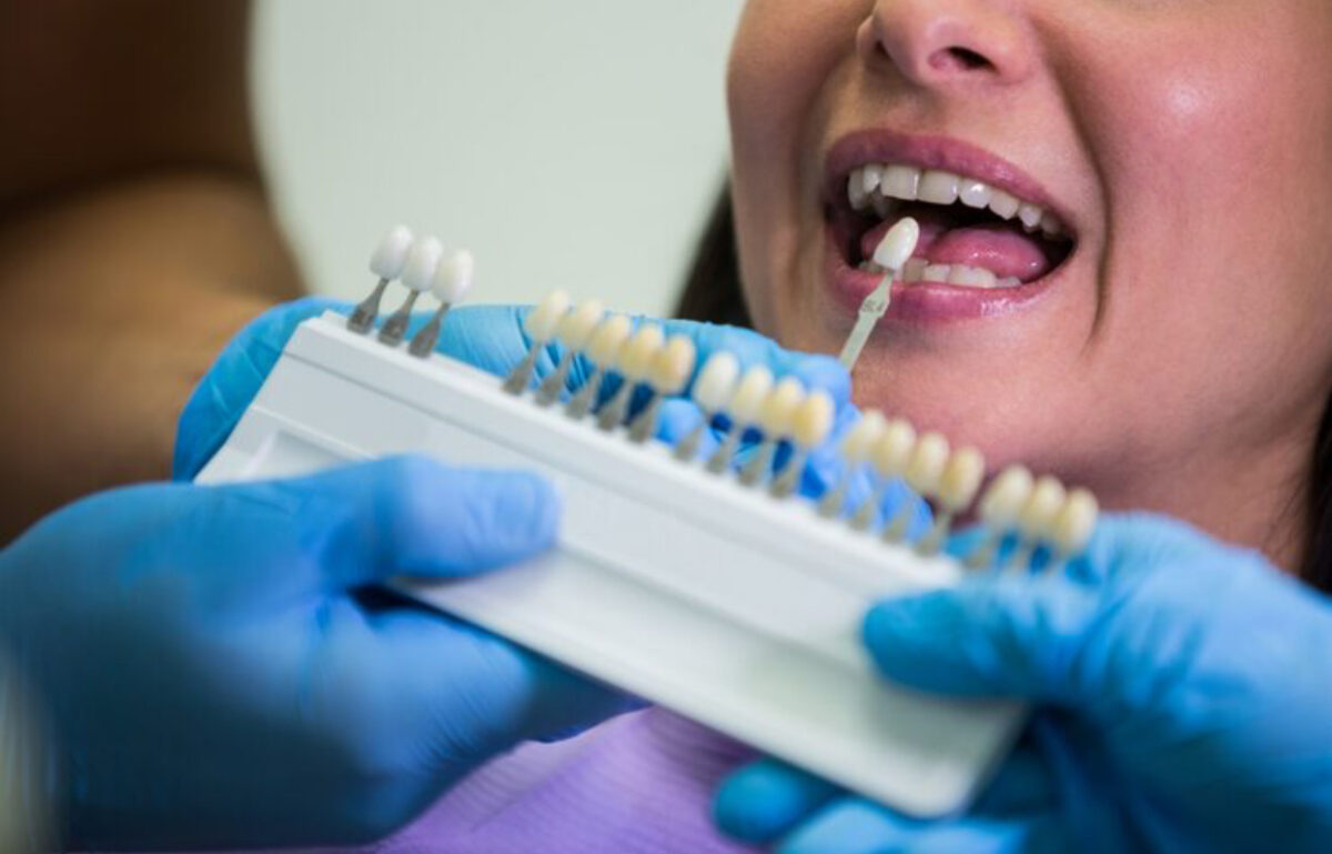 Cât costă un implant dentar în 2025. Puțini români își permit o astfel de procedură