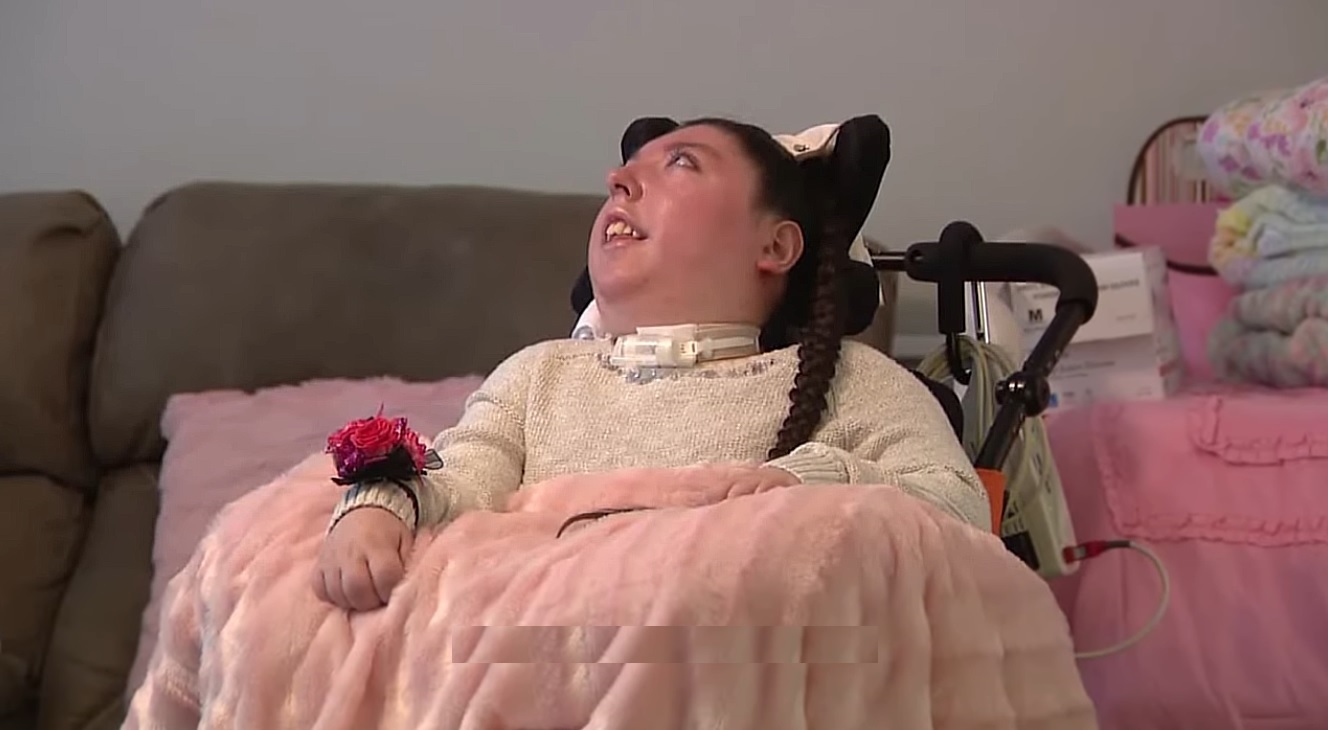 Trăiește de 20 de ani fără o mare parte din creier. Povestea incredibilă a lui Alex Simpson