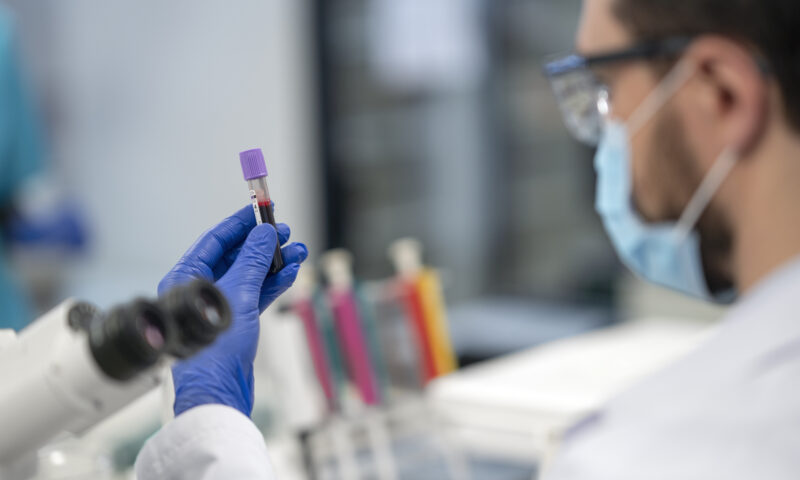 CNAS pregătește eliminarea plafoanelor pentru analizele medicale. Ce se schimbă pentru pacienți