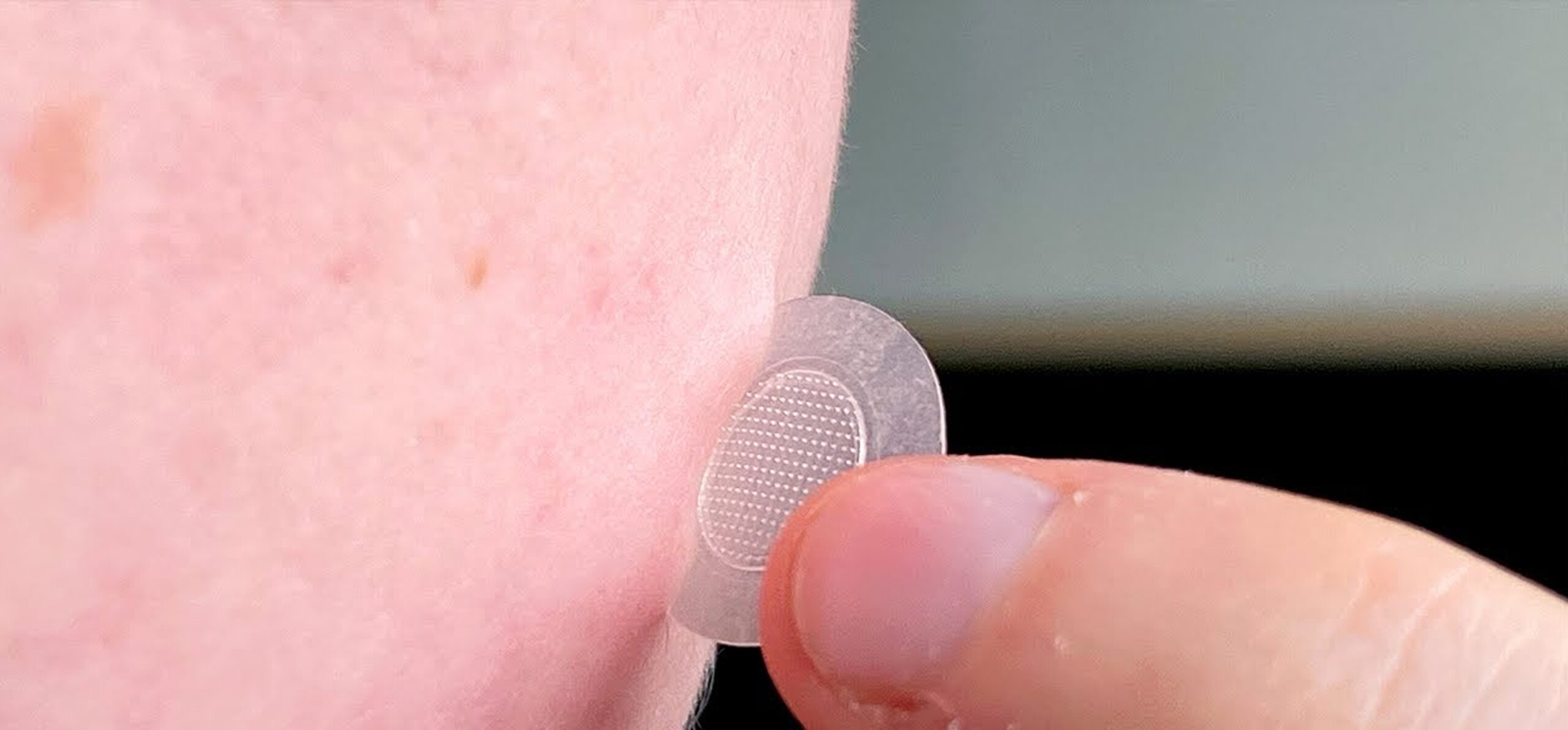 A apărut plasturele care descoperă inflamația din piele. Este cât o monedă