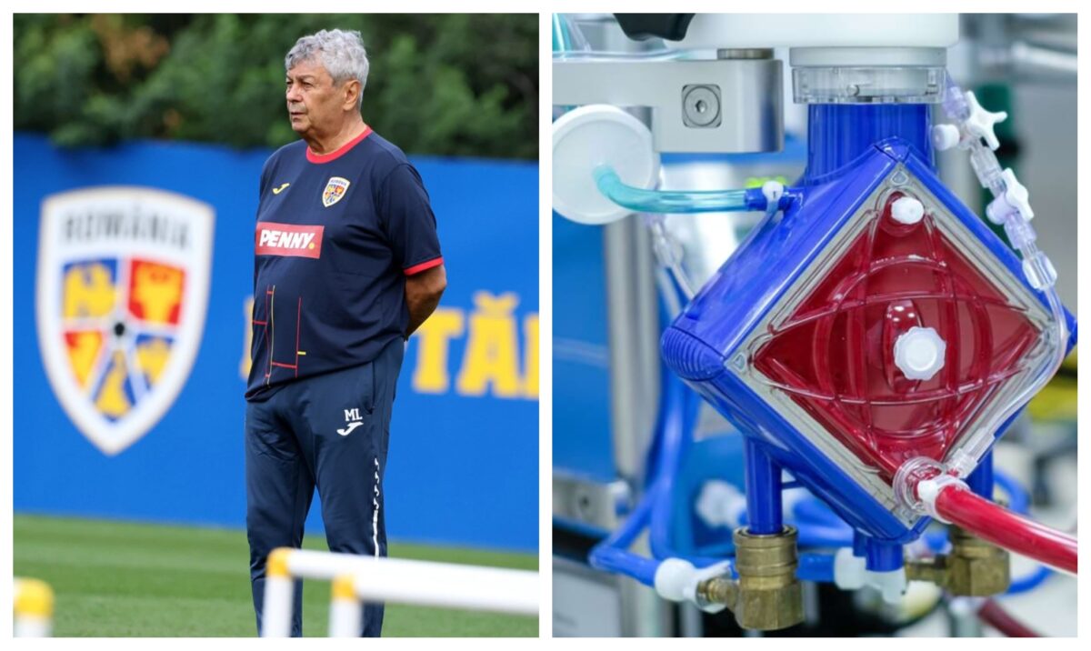 Ce este ECMO, procedura invazivă pentru situații extreme, care i-ar putea salva viața lui Mircea Lucescu