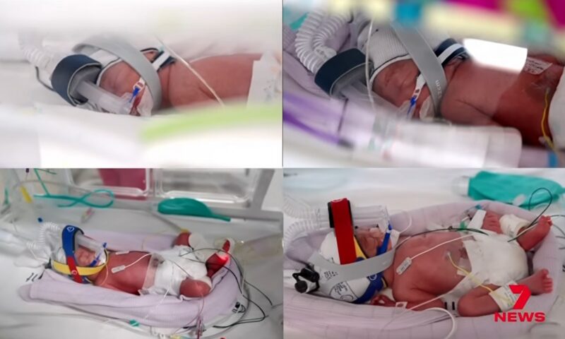 Cvadrupleți identici, concepuți natural, născuți în Australia
