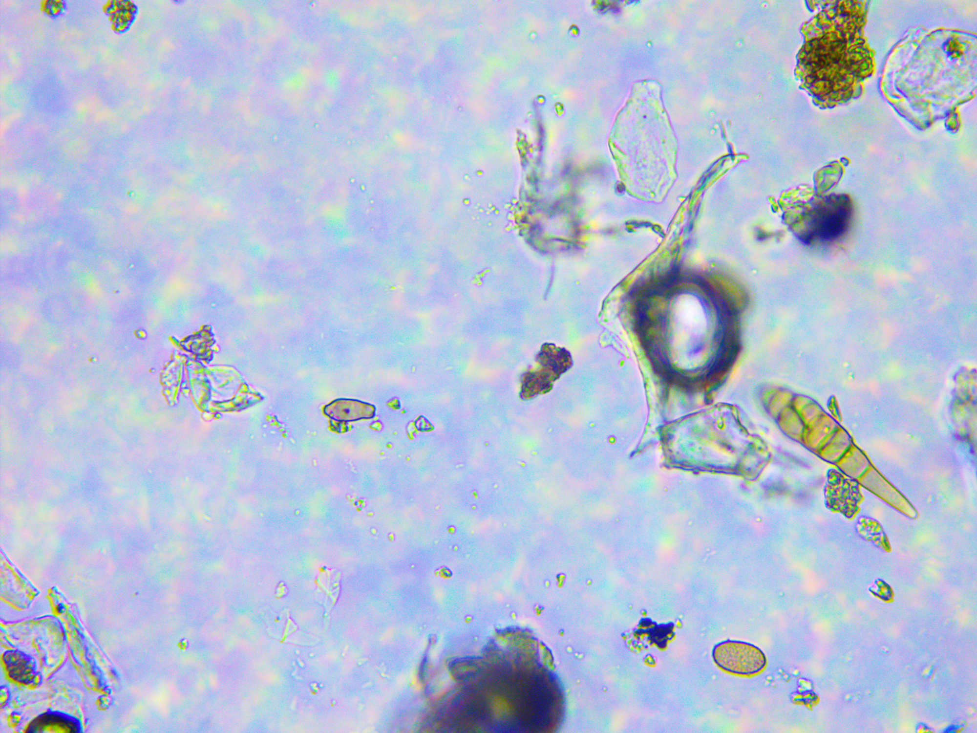 microorganisme
