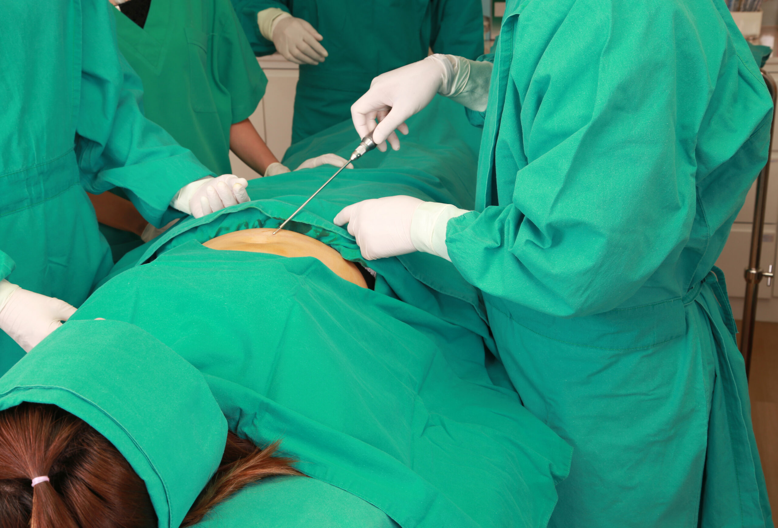 chirurgie estetica